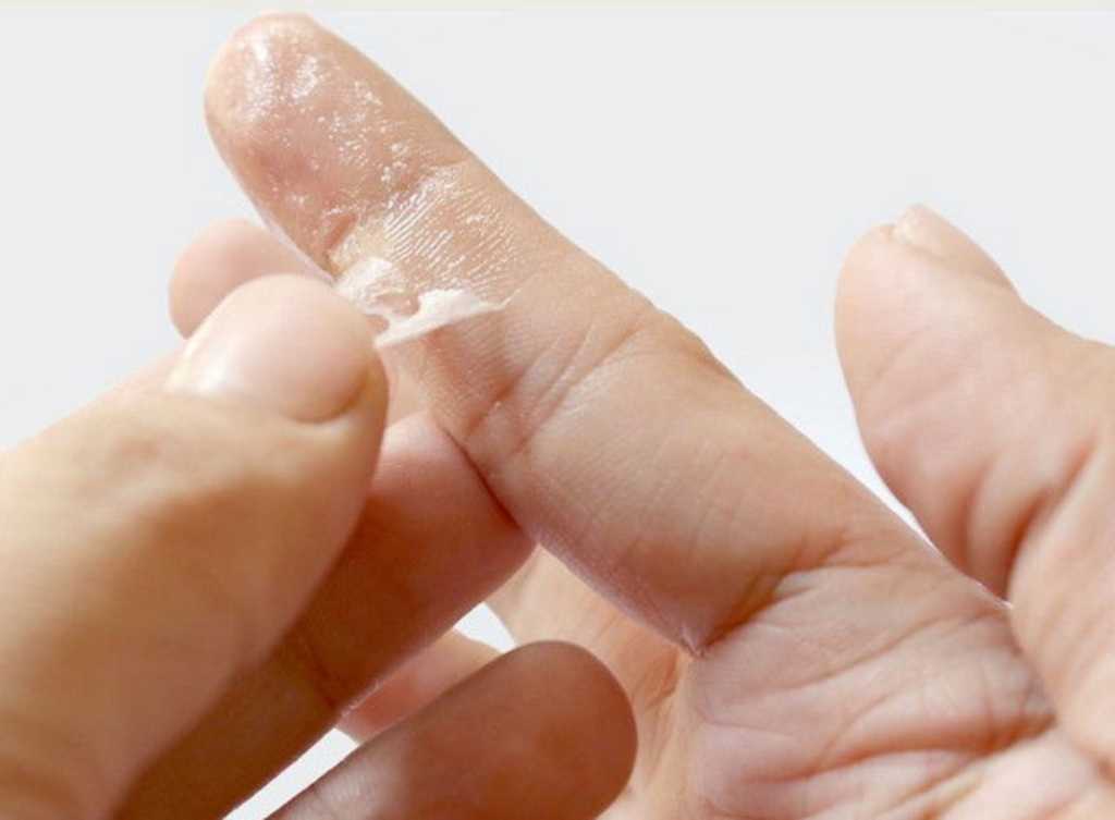 Чем отмыть суперклей с кожи рук, одежды и других предметов